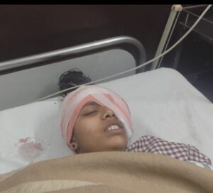 fall into drain नोएडा जैसा हादसा, भाई-बहन नाले में गिरे