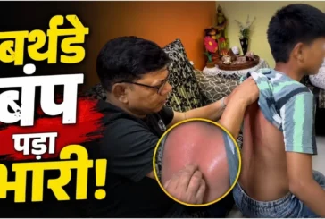 अहम: ऐसे बर्थडे बंप दिए कि लाल हो गई बच्चे की पीठ वायरल ह...