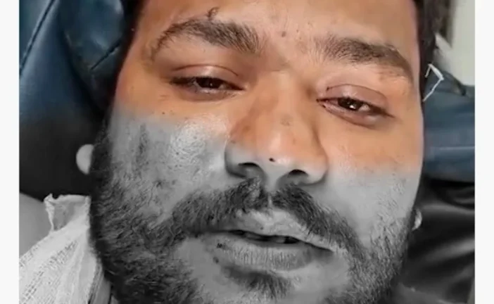 बड़ी खबर: Atiq के बेटे अबान की हादसे में मौत घायल ने बताई...