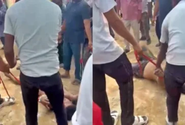 बड़ी खबर: रेबीज का ऐसा कहर तड़पतड़पकर अनीश ने तोड़ा दम